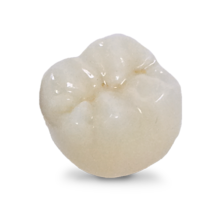 Full-Contour Zirconia