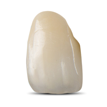 Porcelain-Fused-to-Zirconia